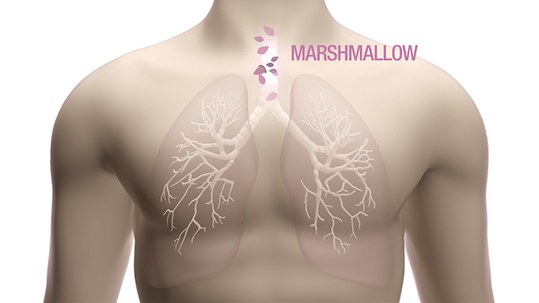 lung marshmallow